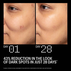 Allies of Skin Azelaic and Kojic Advanced Clarifying Serum 30ml