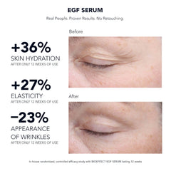 BIOEFFECT EGF Serum (Various Sizes) 