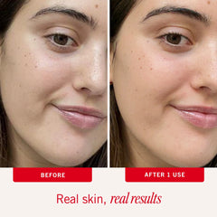 First Aid Beauty Ultra Repair Face Lotion (1.7oz)