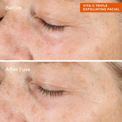Murad Vitamin C Triple Exfoliating Facial Peel 2.7 fl. Oz