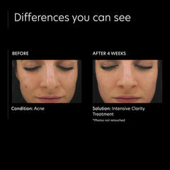 PCA SKIN Intensive Clarity Treatment 0.5 Pure Retinol Night (1 oz.)