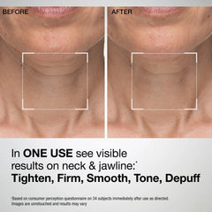 TL Advanced™ Sculpting Neck & Jawline Mask