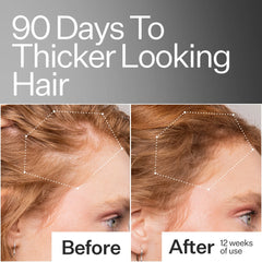 Act+Acre Mini 2% Stem Cell H-2 Grow Complex ™ Scalp Serum For Thicker-Looking Hair 1oz