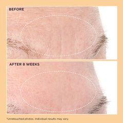 Perricone MD Neuropeptide Deep Crease Serum