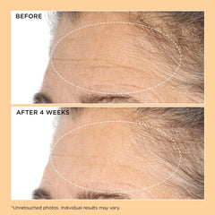 Perricone MD Neuropeptide Duo