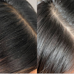 Briogeo Scalp Revival™ Charcoal + Tea Tree Buildup Detox Spray 4 oz