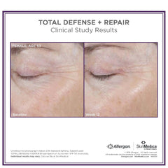 SkinMedica Total Defense + Repair SPF 34 (2.3 oz.)