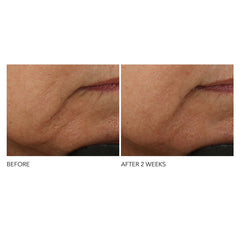 Dr Dennis Gross Advanced Retinol and Ferulic Intense Wrinkle Cream 60ml