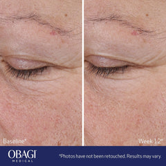 Obagi Medical ELASTIderm Advanced Filler Concentrate (0.67 oz.)