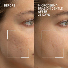 Dr. Brandt Microdermabrasion Renewing Face Exfoliator 2.1 oz