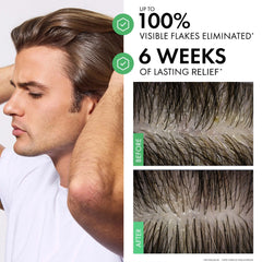 Vichy Dercos Selenium Sulfide Anti-Dandruff Shampoo (Various Sizes)