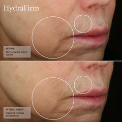 SENTÉ HydraFirm Serum 30ml