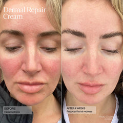 SENTÉ Dermal Repair Cream (1.7 oz.)