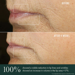 RéVive Skincare Advanced Lip Perioral Serum Targeted Vertical Line Filler 15ml