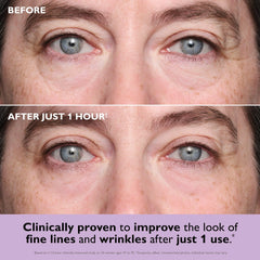 Peter Thomas Roth Collagen Infusion Tightening Eye Patches (8 Pairs)