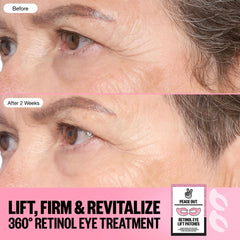 Peace Out Retinol 360° Eye Lift Patches to Lift, Firm and Revitalize Eyes (5 Pairs)