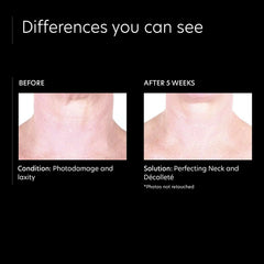 PCA SKIN Perfecting Neck and Decollete (3 oz.)