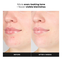 Paula's Choice Skin Perfecting 1% BHA Gentle Exfoliating Gel Toner 100ml