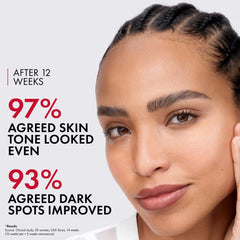 Vichy LiftActiv Pigment Specialist B3 Dark Spot Serum with Melasyl (1 fl.oz.)