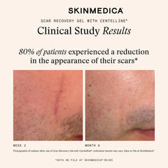 SkinMedica Scar Recovery Gel with Centelline® (2 oz.)